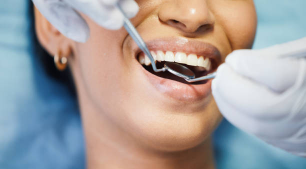 Best Chipped Tooth Repair Near Me  in Temecula, CA